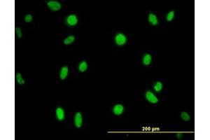 Image no. 1 for anti-N-Methylpurine-DNA Glycosylase (MPG) (AA 1-90) antibody (ABIN598819) (MPG Antikörper  (AA 1-90))