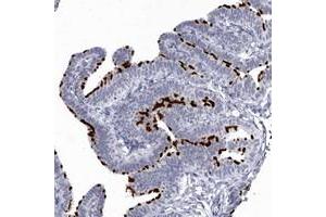 Immunohistochemical staining of human fallopian tube with C1orf114 polyclonal antibody  shows strong membranous positivity in glandular cells. (C1orf114 Antikörper)
