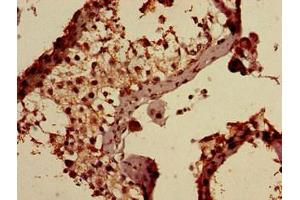 Immunohistochemistry of paraffin-embedded human testis tissue using ABIN7144358 at dilution of 1:100 (AP1S3 Antikörper  (AA 1-104) (Biotin))