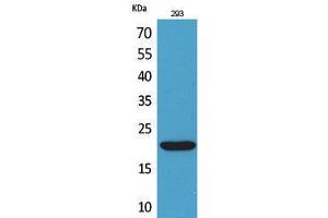 Western Blotting (WB) image for anti-CKLF-Like MARVEL Transmembrane Domain Containing 6 (CMTM6) (C-Term) antibody (ABIN3187825)
