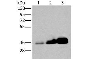 Western blot analysis of Human testis tissue NIH/3T3 and 231 cell lysates using UBE2Z Polyclonal Antibody at dilution of 1:350 (UBE2Z Antikörper)