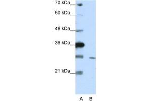 Western Blotting (WB) image for anti-Zinc Finger Protein 397 (ZNF397) antibody (ABIN2461947) (ZNF397 Antikörper)