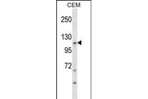 KIT Antibody (Ascites) ABIN1539990 western blot analysis in CEM cell line lysates (35 μg/lane). (KIT Antikörper)