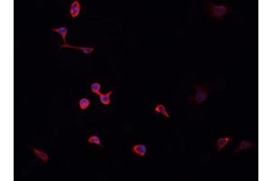 ABIN6268820 staining HeLa cells by IF/ICC. (HNRNPA2B1 Antikörper  (N-Term))