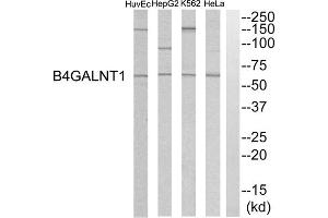 Western blot analysis of extracts from HeLa cells, K562 cells, HepG2 cells and HuvEC cells, using B4GALNT1 antibody. (B4GALNT1 Antikörper  (Internal Region))