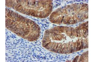 Image no. 12 for anti-F-Box Protein 21 (FBXO21) antibody (ABIN1498235)