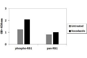 Retinoblastoma 1 ELISA Kit