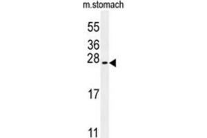 Western Blotting (WB) image for anti-Dynein, Cytoplasmic 2, Heavy Chain 1 (DYNC2H1) antibody (ABIN3002490) (DYNC2H1 Antikörper)
