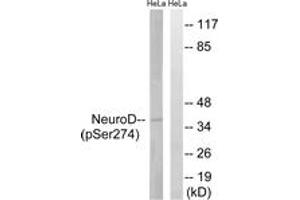 Western blot analysis of extracts from HeLa cells treated with UV 15', using Neuro D (Phospho-Ser274) Antibody. (NEUROD1 Antikörper  (pSer274))