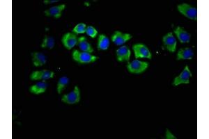 Immunofluorescence staining of A549 cells with ABIN7158410 at 1:66, counter-stained with DAPI. (LIPH Antikörper  (AA 175-325))