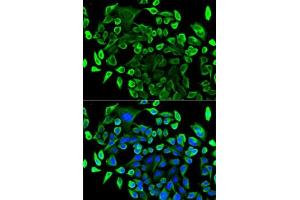 Immunofluorescence analysis of U2OS cells using T antibody (ABIN6131955, ABIN6148795, ABIN6148796 and ABIN6221421). (TAB1 Antikörper  (AA 205-504))