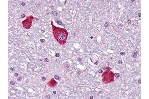 Immunohistochemical staining of Brain (Neurons and glia) using anti- PTHR2 antibody ABIN122363 (PTH2R Antikörper  (C-Term))