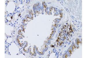Immunohistochemistry of paraffin-embedded rat lung using RARA antibody. (Retinoic Acid Receptor alpha Antikörper)