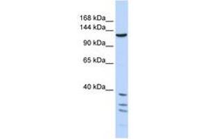 Image no. 1 for anti-Tankyrase, TRF1-Interacting Ankyrin-Related ADP-Ribose Polymerase (TNKS) (AA 1079-1128) antibody (ABIN6740351) (TNKS Antikörper  (AA 1079-1128))
