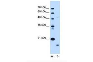 Image no. 1 for anti-Zinc Metalloproteinase, Ste24 (Zmpste24) (AA 83-132) antibody (ABIN6738260) (ZMPSTE24 Antikörper  (AA 83-132))
