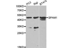 Western blot analysis of extracts of various cell lines, using SPAM1 antibody. (SPAM1 Antikörper  (AA 100-300))