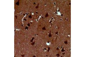 Immunohistochemical analysis of Alpha-synuclein (pY125) staining in human brain formalin fixed paraffin embedded tissue section. (SNCA Antikörper  (C-Term, pTyr125))