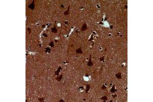 Immunohistochemical analysis of Alpha-synuclein (pY125) staining in human brain formalin fixed paraffin embedded tissue section.