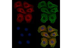 ABIN6256887 and ABIN6274764 staining Hela cells by IF/ICC. (TROVE2 Antikörper  (N-Term))