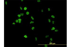 Immunofluorescence of monoclonal antibody to CSE1L on HeLa cell. (Exportin 2 Antikörper  (AA 872-971))