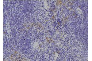 ABIN6268882 at 1/100 staining Human spleen tissue by IHC-P. (Fibronectin 1 Antikörper  (C-Term))