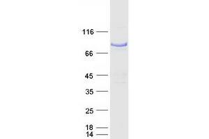 Validation with Western Blot