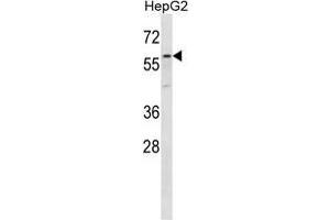 ZP4 Antibody (C-term) western blot analysis in HepG2 cell line lysates (35 µg/lane).