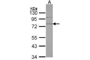 WB Image Sample (30 ug of whole cell lysate) A: Hela 10% SDS PAGE antibody diluted at 1:1000 (SRPX Antikörper)