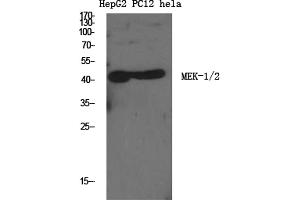 Western Blotting (WB) image for anti-Mitogen-Activated Protein Kinase Kinase 1/2 (MAP2K1/2) (Ser222), (Ser226) antibody (ABIN5961680) (MEK1/2 Antikörper  (Ser222, Ser226))