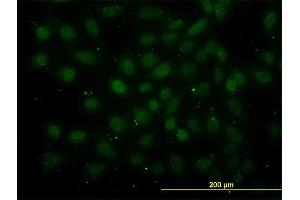 Immunofluorescence of monoclonal antibody to GABPA on HeLa cell. (GABPA Antikörper  (AA 1-100))