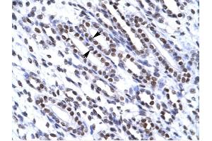 Immunohistochemistry (IHC) image for anti-X-Ray Repair Complementing Defective Repair in Chinese Hamster Cells 6 (XRCC6) (N-Term) antibody (ABIN629624)