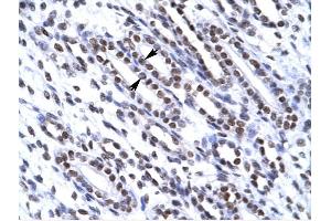G22P1 antibody was used for immunohistochemistry at a concentration of 4-8 ug/ml to stain Epithelial cells of renal tubule (arrows) in Human Kidney. (XRCC6 Antikörper  (N-Term))