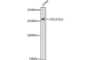 Western blot analysis of extracts of Jurkat cells, using CR2/CD21 antibody (ABIN1678995, ABIN3015431, ABIN3015432 and ABIN7101406) at 1:1000 dilution. (CD21 Antikörper)