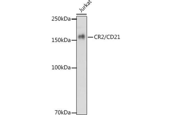 CD21 Antikörper
