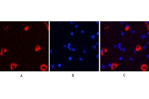 Immunofluorescence analysis of mouse brain tissue. (MAP2 Antikörper)