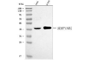 Western blot analysis of PI2/SERPINB1 using anti-PI2/SERPINB1 antibody (ABIN7601949).