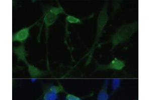 Immunofluorescence analysis of U-251 MG cells using FABP7 Polyclonal Antibody at dilution of 1:100. (FABP7 Antikörper)