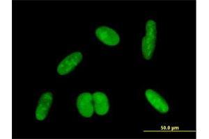 Immunofluorescence of purified MaxPab antibody to ZNF169 on HepG2 cell. (ZNF169 Antikörper  (AA 1-590))
