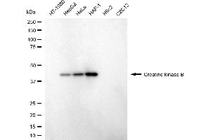 Western blotting analysis using creatine kinase B antibody (ABIN7798160). (CKB Antikörper)