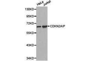Western Blotting (WB) image for anti-CDKN2A Interacting Protein (CDKN2AIP) antibody (ABIN1871760) (CDKN2AIP Antikörper)