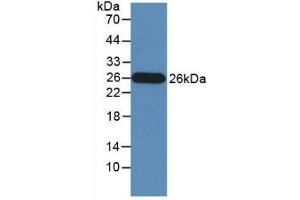 Detection of Recombinant GZMM, Human using Monoclonal Antibody to Granzyme M (GZMM)