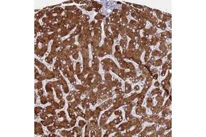 Immunohistochemical staining of human liver with ZNF844 polyclonal antibody  shows strong cytoplasmic positivity in hepatocytes at 1:50-1:200 dilution.