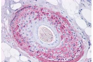 Immunohistochemistry (IHC) image for anti-Growth Hormone Secretagogue Receptor (GHSR) (Internal Region) antibody (ABIN1048650)