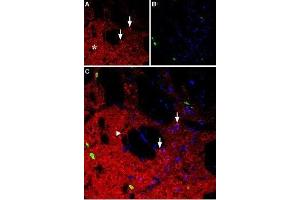 Expression of neuropeptide Y1 receptor in rat striatumImmunohistochemical staining of rat striatum using Anti-NPY1R Antibody (ABIN7043371, ABIN7044668 and ABIN7044669). (Neuropeptide Y Receptor Y1 (NPY1R) Peptid)