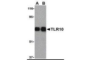 Western Blotting (WB) image for anti-Toll-Like Receptor 10 (TLR10) antibody (ABIN2479798) (TLR10 Antikörper)