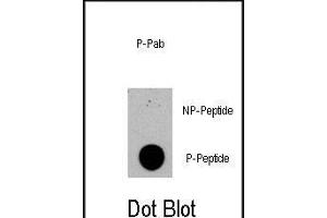 Dot blot analysis of anti-TSC2-p Phospho-specific Pab (R) on nitrocellulose membrane. (Tuberin Antikörper  (pSer1420))