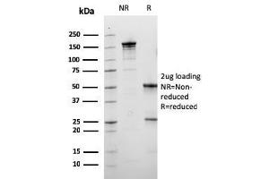 SDS-PAGE Analysis Purified Calbindin 1 Mouse Monoclonal Antibody (CALB1/3333). (CALB1 Antikörper  (AA 7-96))