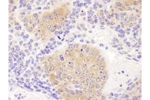 Immunohistochemistry (IHC) image for anti-Chaperonin Containing TCP1, Subunit 8 (Theta) (CCT8) (AA 398-448) antibody (ABIN7453619) (CCT8 Antikörper  (AA 398-448))