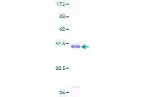 Image no. 1 for Fibroblast Growth Factor 21 (FGF21) (AA 30-209) protein (GST tag) (ABIN1354016)
