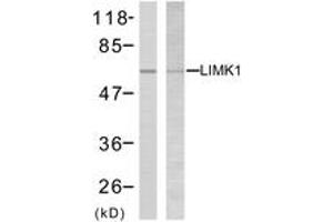 Western blot analysis of extracts from NIH-3T3 cells, treated with UV, using LIMK2 (Ab-505) Antibody.
